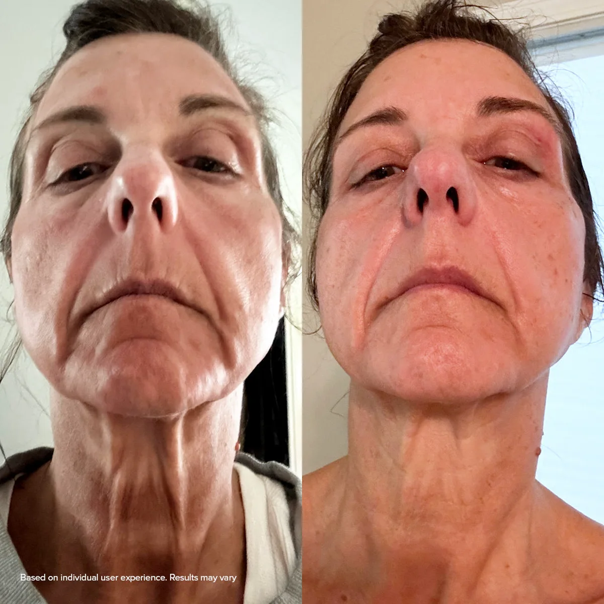 Antes e depois real de usuária: contorno mais definido